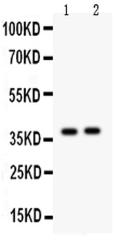 Anti-Calretinin/CALB2 Antibody
