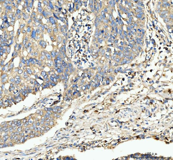 CD63 Rabbit Polyclonal Antibody
