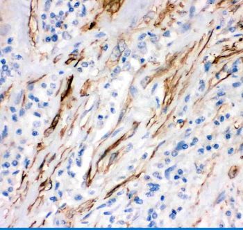 Anti-Fas Antibody