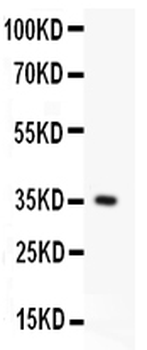 Anti-Fas Antibody