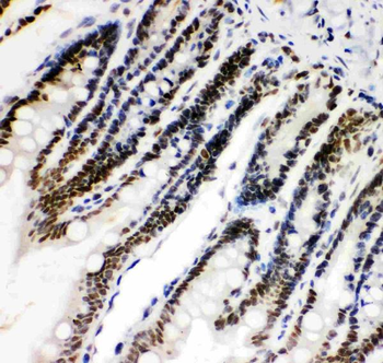 Anti-HIF-1-alpha/HIF1A Antibody