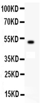 c-Kit Antibody