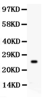 Anti-Kallikrein 4/KLK4 Antibody
