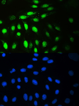 Anti-MCM7 Antibody