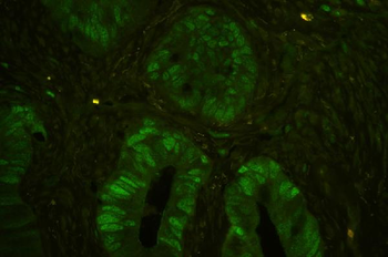 Anti-MCM7 Antibody