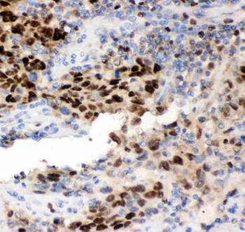Anti-MCM7 Antibody