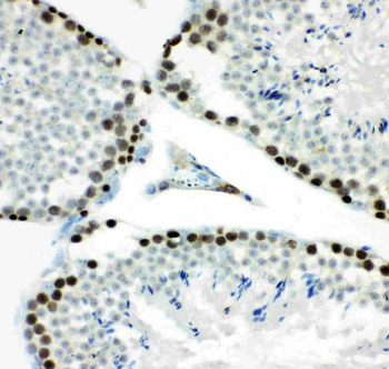 Anti-MCM7 Antibody