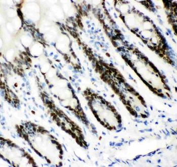Anti-MCM7 Antibody