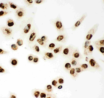 Anti-MCM7 Antibody