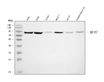 Anti-MCM7 Antibody