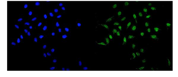 Anti-MAD1/MAD1L1 Antibody