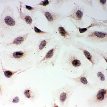 Anti-MAD1/MAD1L1 Antibody