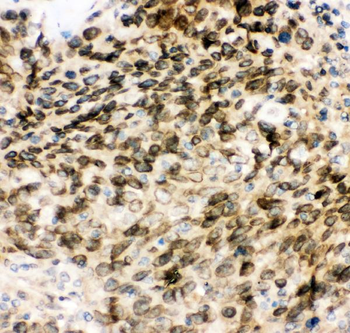 Anti-MAD1/MAD1L1 Antibody