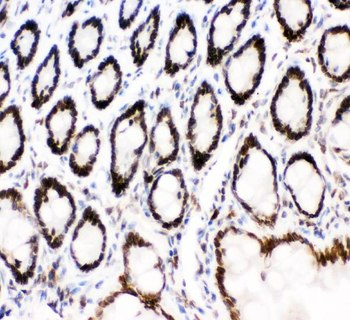 Anti-MAD1/MAD1L1 Antibody