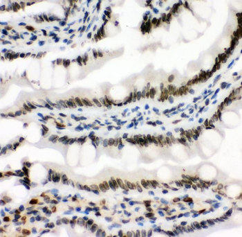 Anti-MAD1/MAD1L1 Antibody