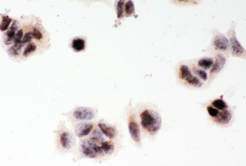 Anti-MGMT Antibody
