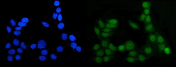 Anti-MGMT Antibody