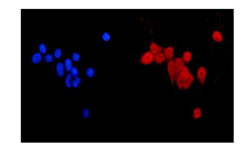 Anti-MGMT Antibody