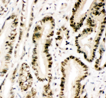 Anti-MGMT Antibody