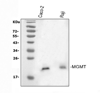 Anti-MGMT Antibody