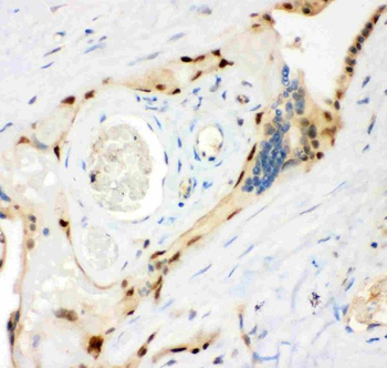 Anti-MSK1/RPS6KA5 Antibody