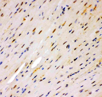 Anti-MSK1/RPS6KA5 Antibody