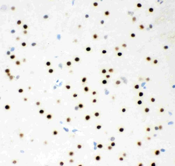 Anti-MSK1/RPS6KA5 Antibody