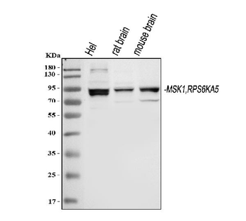 Anti-MSK1/RPS6KA5 Antibody