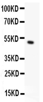 Anti-TRPC5 Antibody