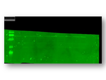 Anti-TRPC5 Antibody