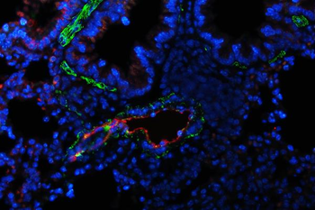 Anti-Von Willebrand Factor/VWF Antibody