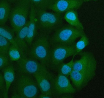 Anti-MIF Antibody