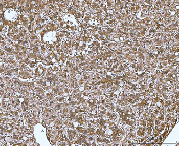 Anti-MIF Antibody