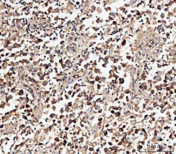 Anti-MIF Antibody