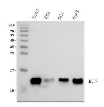 Anti-MIF Antibody