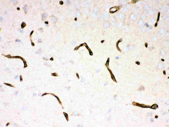 Anti-Dystrophin/DMD Antibody