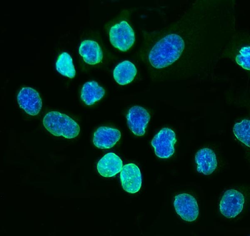 Anti-Lamin A+C/LMNA Antibody