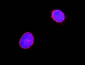 Anti-Lamin A+C/LMNA Antibody
