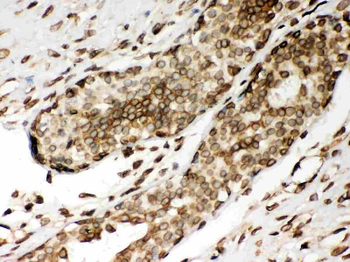 Anti-Lamin A+C/LMNA Antibody
