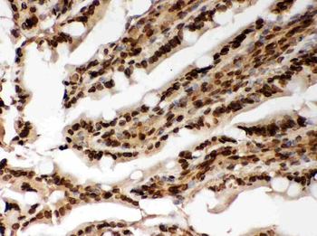 Anti-Lamin A+C/LMNA Antibody