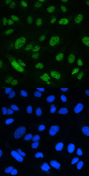 Anti-MSH2 Antibody