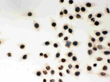 Anti-MSH2 Antibody