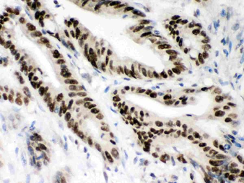 Anti-MSH2 Antibody