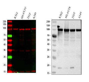 Anti-MSH2 Antibody