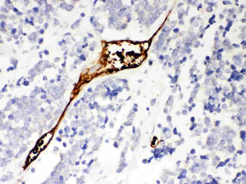 Anti-Mesothelin/MSLN Antibody