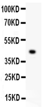Anti-Mesothelin/MSLN Antibody