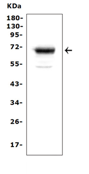 Anti-Mesothelin/MSLN Antibody