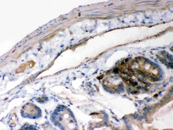Anti-IKB alpha/NFKBIA Antibody