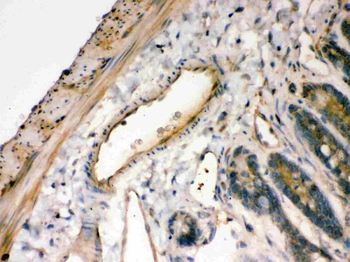 Anti-IKB alpha/NFKBIA Antibody