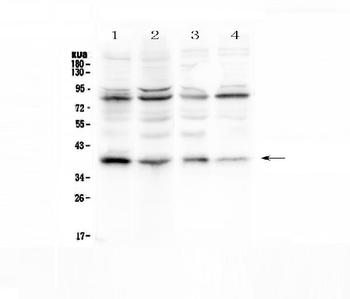 Anti-IKB alpha/NFKBIA Antibody